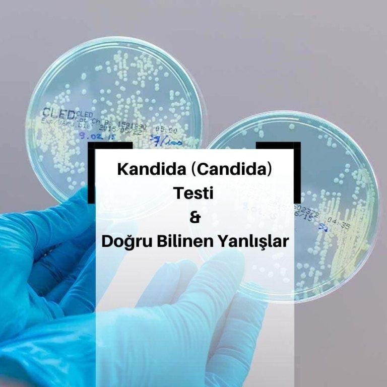 Kandida Testi (Candida) Nasıl Yapılır?